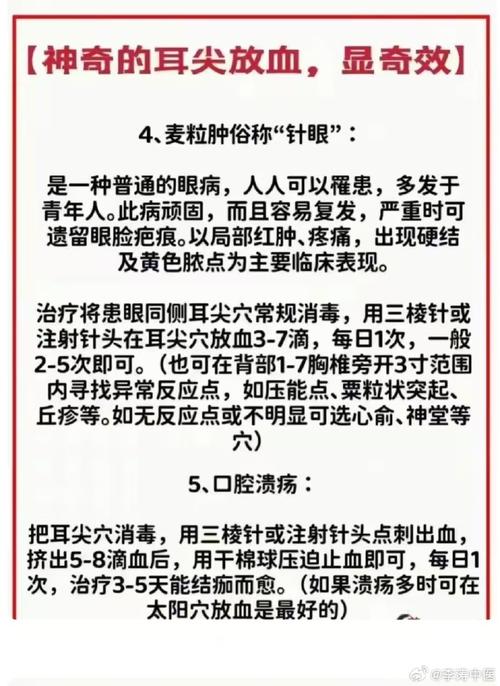 神奇!“耳尖放血”居然能治荨麻疹?中医治疗荨麻疹有何妙招?