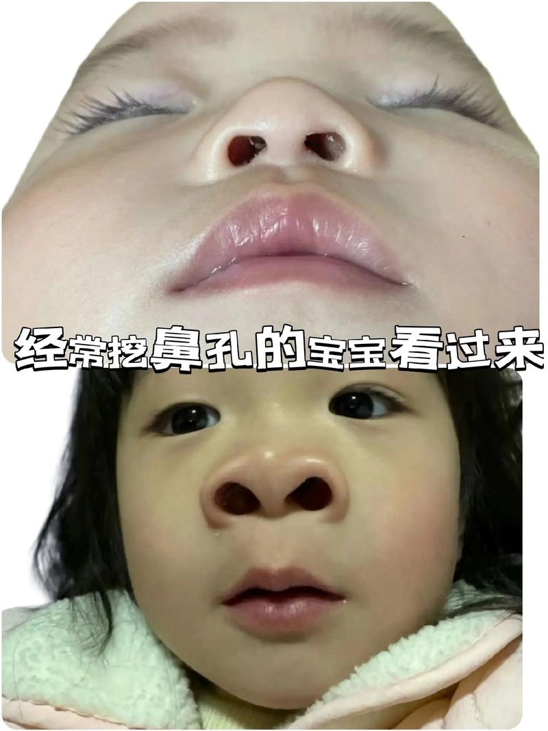 八龄童抠鼻险丧命!很多人还天天这样做