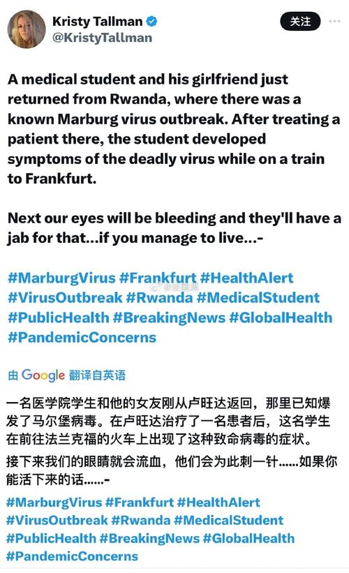 卢旺达启动全球首次马尔堡病毒病治疗临床试验